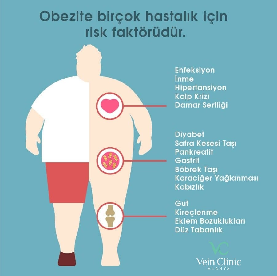 Op.Dr.ilker Zan - Obezite bir çok hastalığa sebep olduğu gibi kalp ve ...