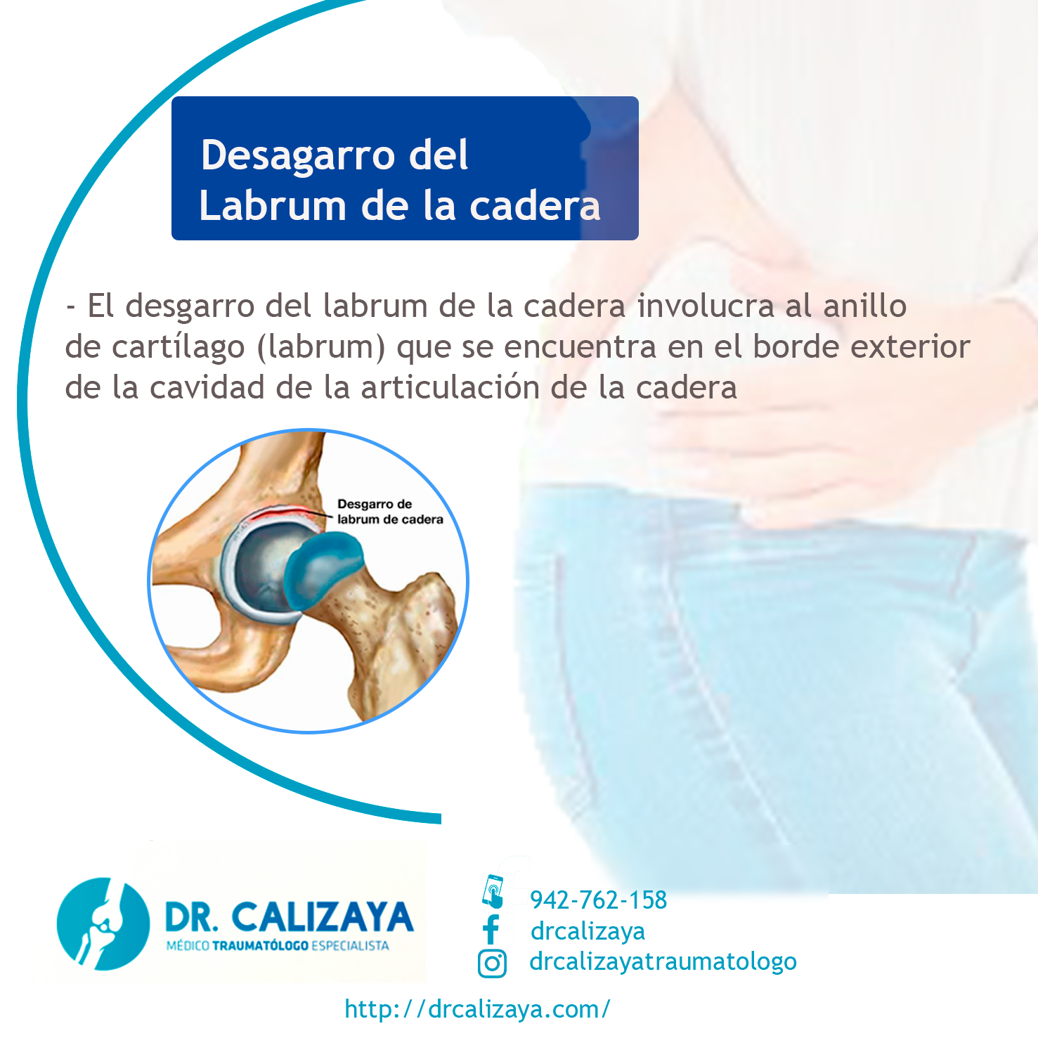 Dr. Calizaya - Los desgarros del labrum de la cadera...