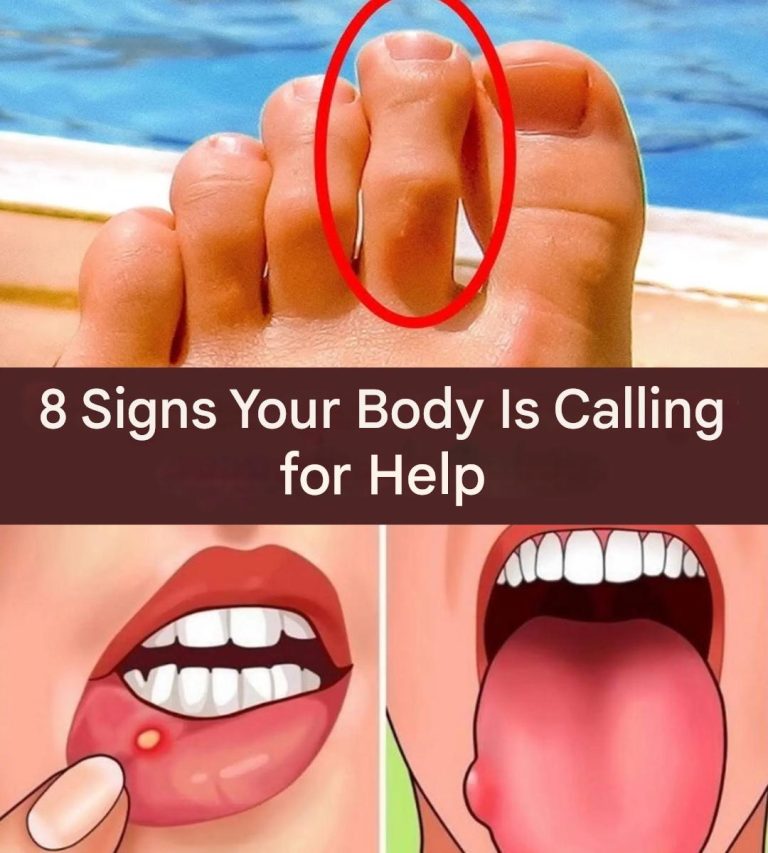 Grandma's recipes Lovers | # **8 signs your body is crying out for help ...