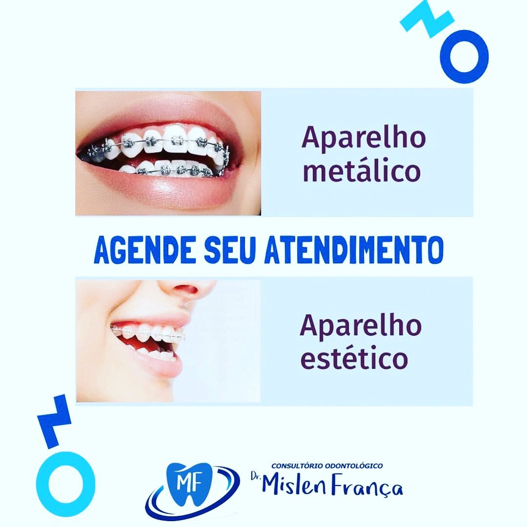Consultório Odontológico Dr Mislen França | Umburanas BA