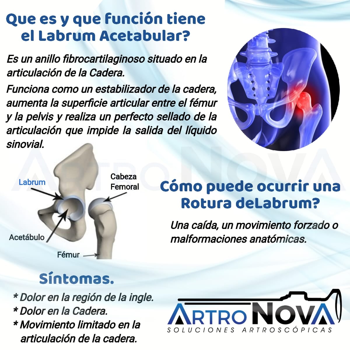 ArtroNova - Que es y que Función tiene el Labrum...