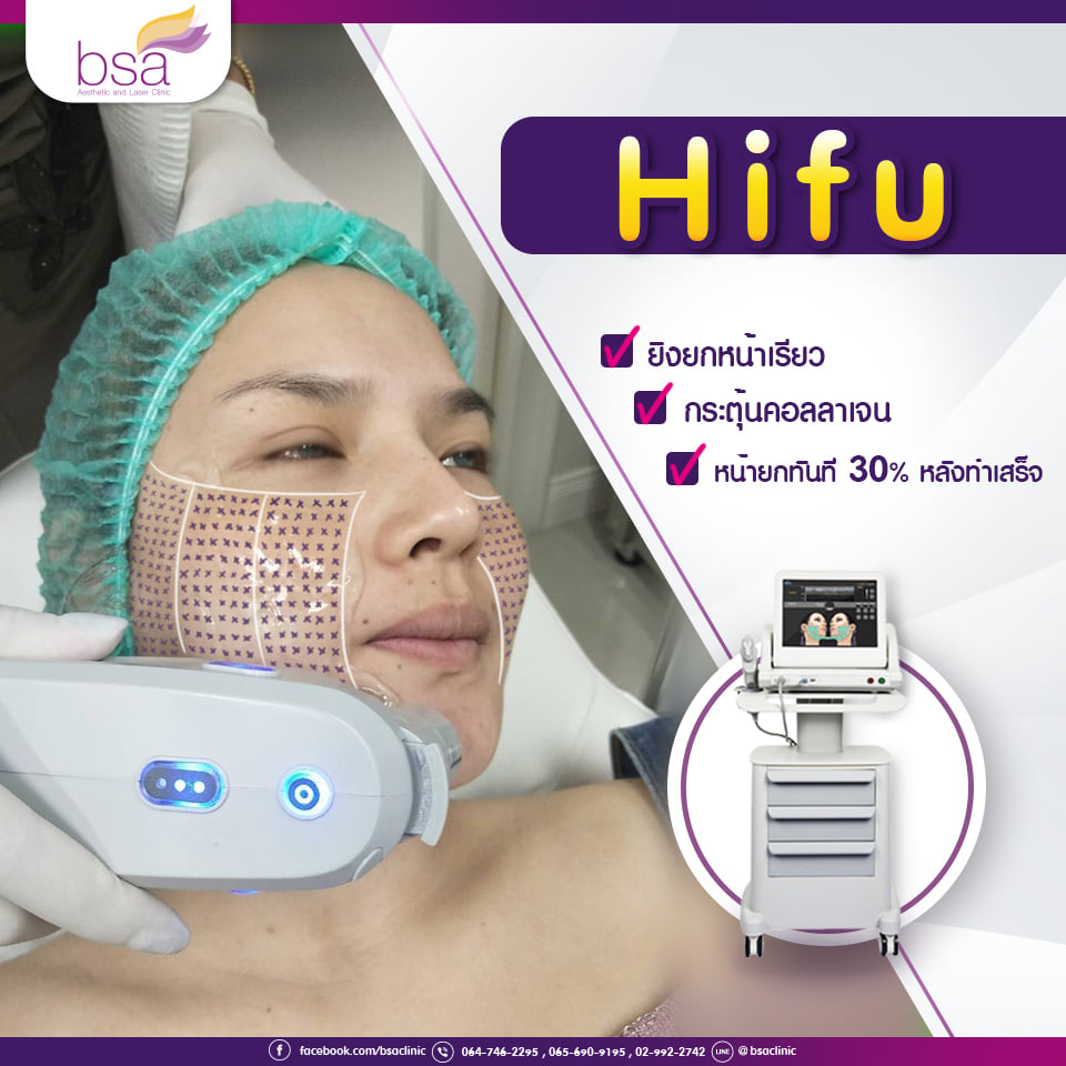 BSA Clinic - HIFU ยิงหน้าเรียว กระตุ้นคอลลาเจน ...