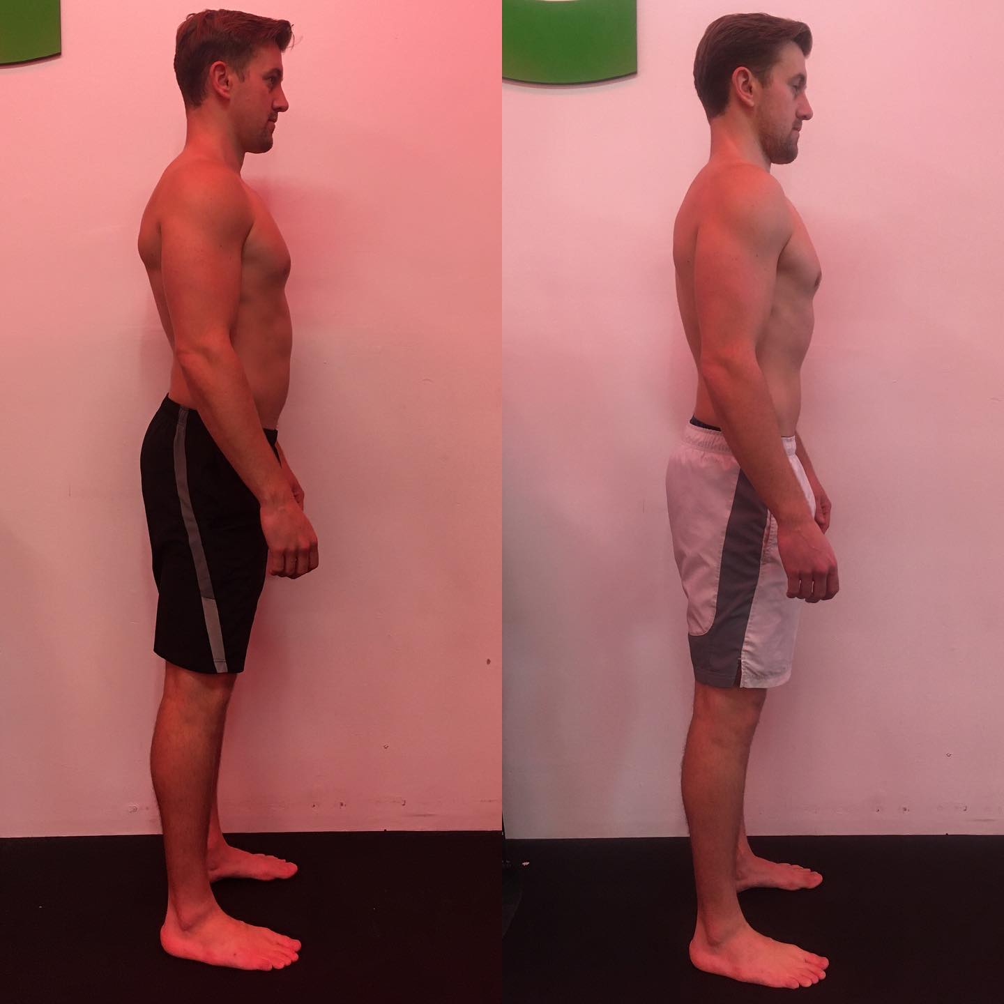 bpc 157 before and after bodybuilding Unlocking Muscle Growth: The Power of Peptide Bpc-157 treatment for back and