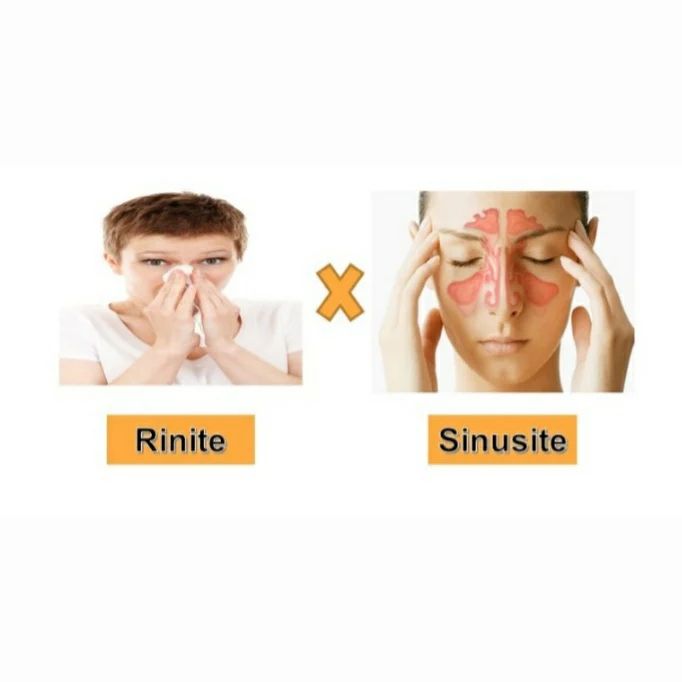 🔹 RINITE X SINUSITE 🔸 A rinite é a... - Lab Morfo Virtual