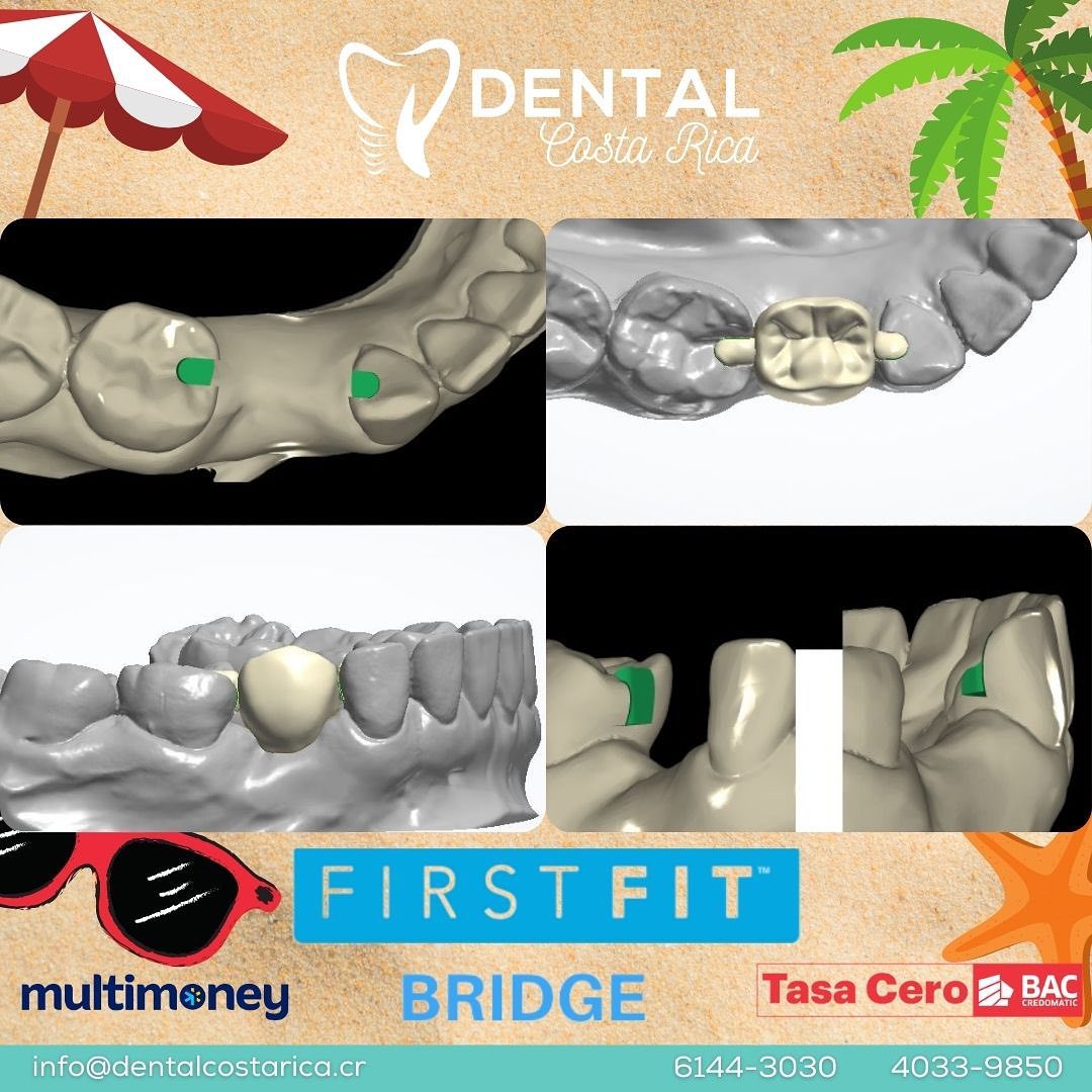 Caso de una paciente que no candidata... - Dental Costa Rica