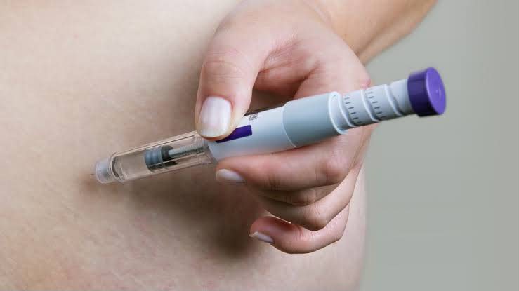 Does tirzepatide affect menstrual cycles and hormone balance in PCOS patients?