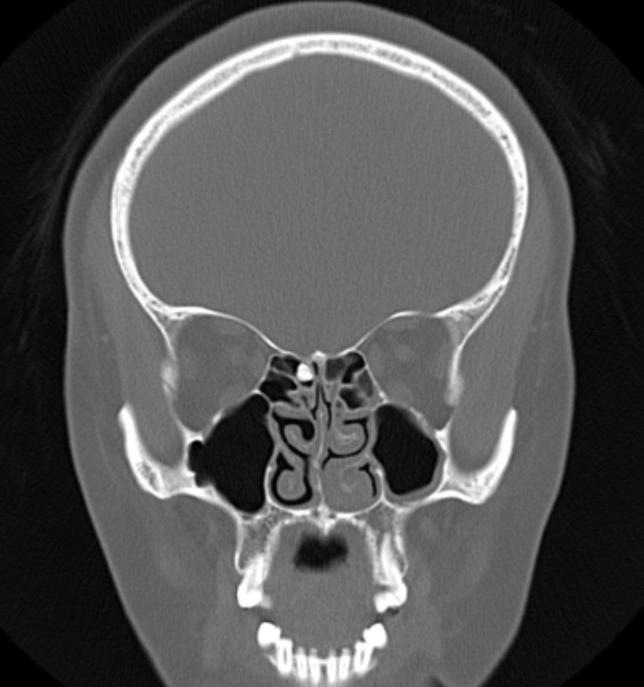 Radiology Case Cafe