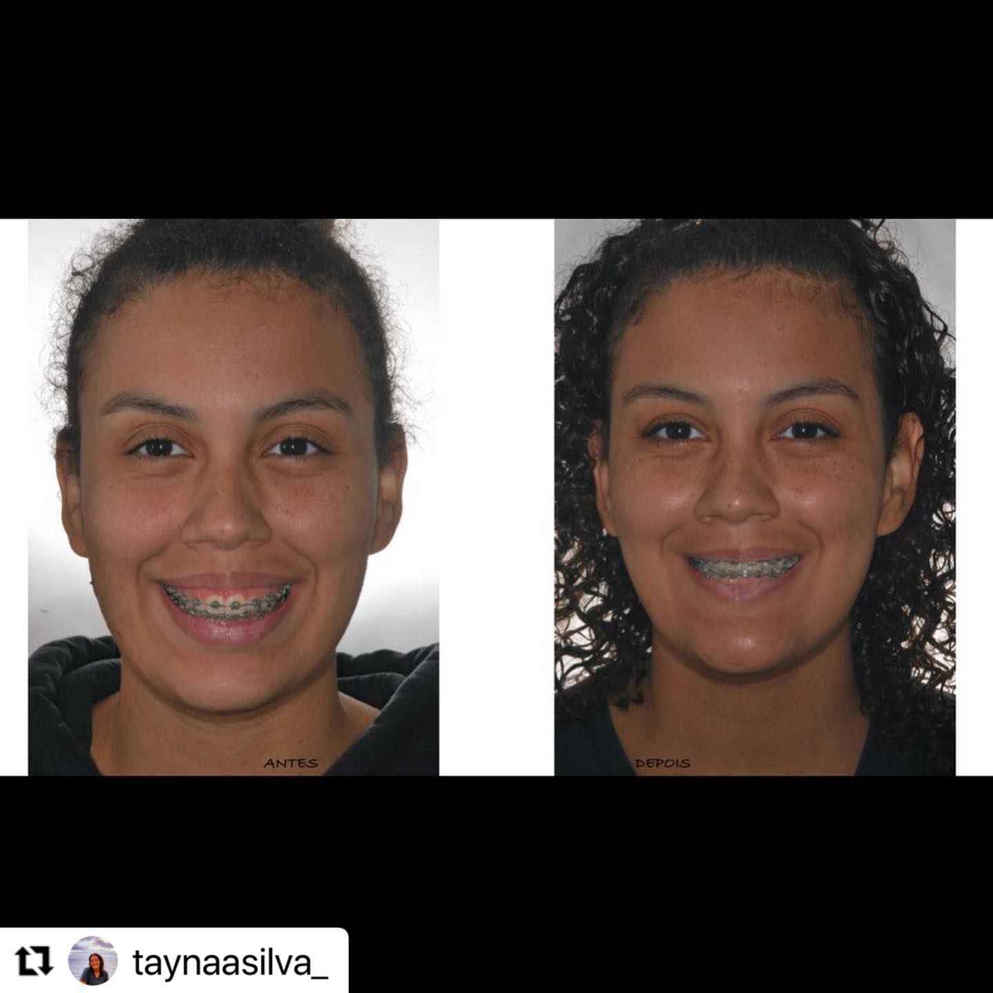 Alpha Face Odontologia - 💙Quem sempre deixa um sorriso bonito, também ...