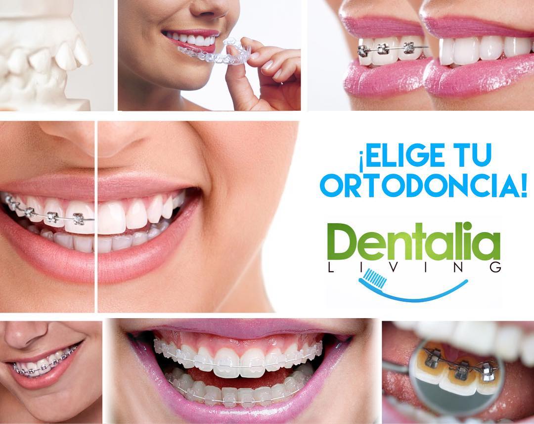 Dentalia Living D.P.D SRL - Elige el tipo de ortodoncia más adecuado a ...
