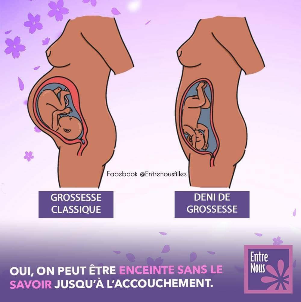 Rever De Faire Un Deni De Grossesse
