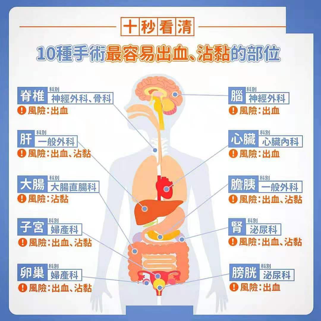 Apple Pang Mº27品牌精英領導72 健康知识 最容易出血的手术 不同手术项目中 可能会面临不同的手术风险 像是沾黏最常见在腹部 妇产科等手术上 包含子宫切除 肌瘤切除都是建议可以考虑使用抗沾黏产品的手术 Facebook