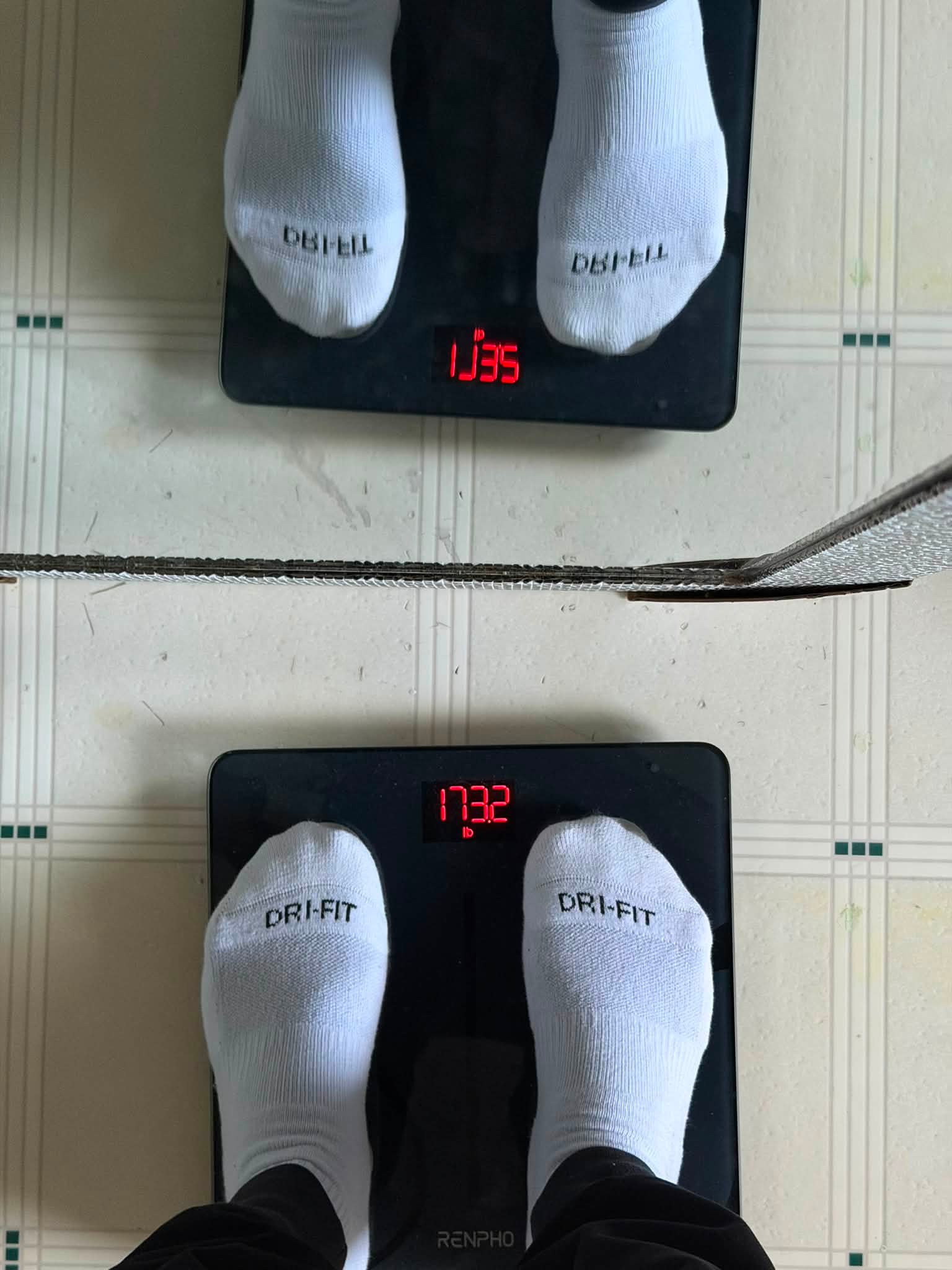 Leg and feet discomfort with GLP-1 weight loss