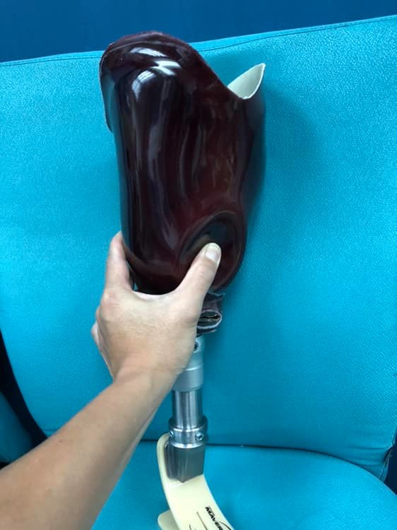 BK #ProtheFlex system socket in Asia -... - ProtheFlex system | Facebook