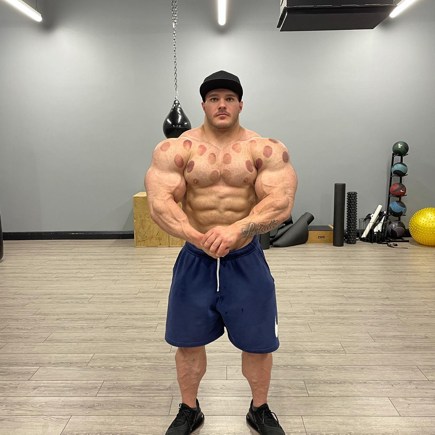 Nick Walker - Excuse the cupping. Post workout pics after...