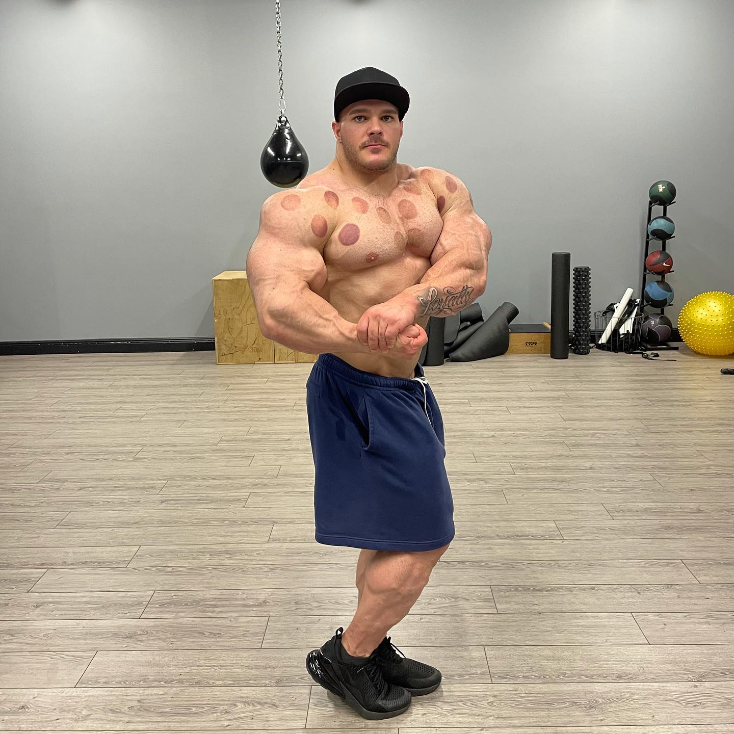 Nick Walker - Excuse the cupping. Post workout pics after...