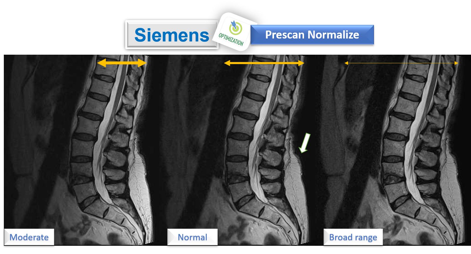 MRI - 
