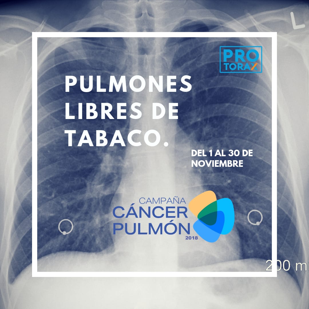 Entérate y se un... - Protorax de Colombia. Cirugía de Tórax. | Facebook