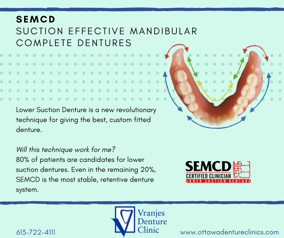 New revolutionary Lower Suction... - Vranjes Denture Clinic | Facebook