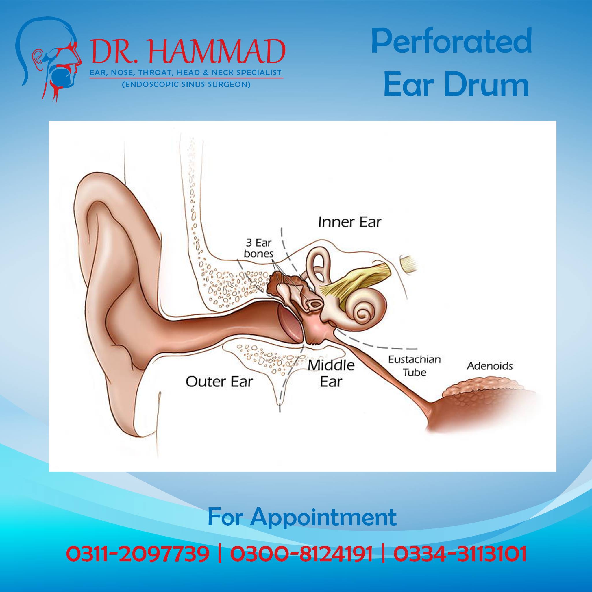 A ruptured... - Dr. Hammad - ENT, Head & Neck Specialist