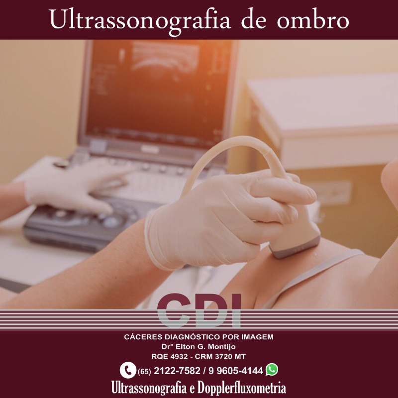 A... - CDIN Centro de Diagnóstico por Imagem e Neurologia