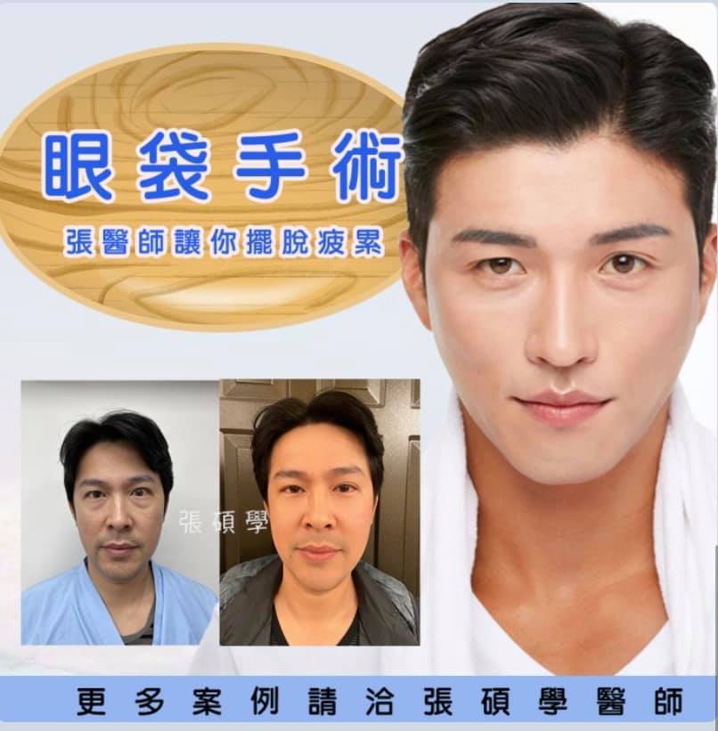 張碩學醫師-醫美魔術手 - 眼袋手術讓你不再疲憊 明明睡飽還是一臉倦容 眼下兩代陰影改善不了... | Facebook