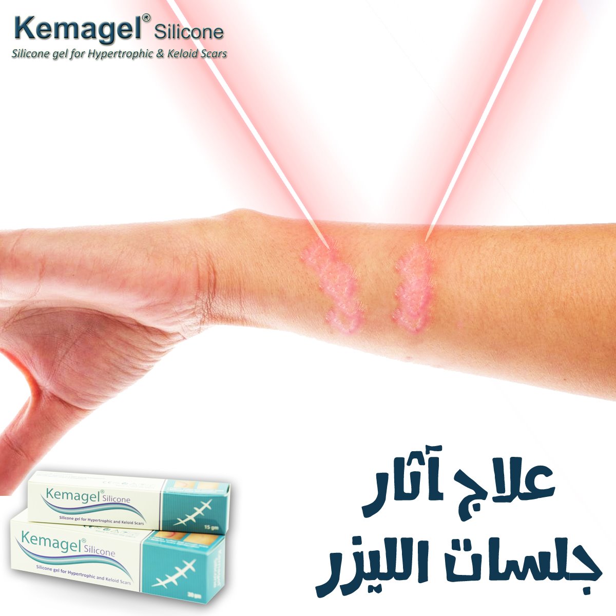 Kemagel Silicone فى الأغلب يتم إستخدام الليزر للتخلص من الحروق أو الجروح القديمة التى لها أثر سئ وتشوه الشكل والبشرة بعد العلاج بالليزر من الممكن أن يظل أثر الليزر داكن أو