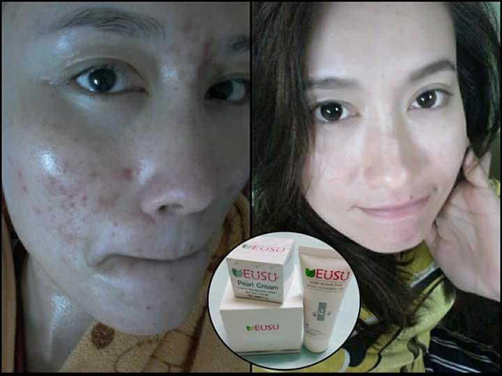 รีวิว มารัวๆ อยากมีใบหน้า ขาว... - EUSU ผลิตภัณฑ์ดูแลผิวหน้า | Facebook