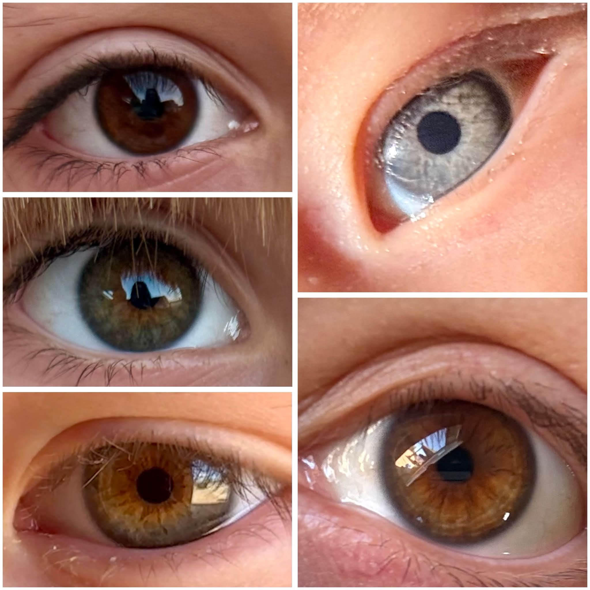 What color is the eye?