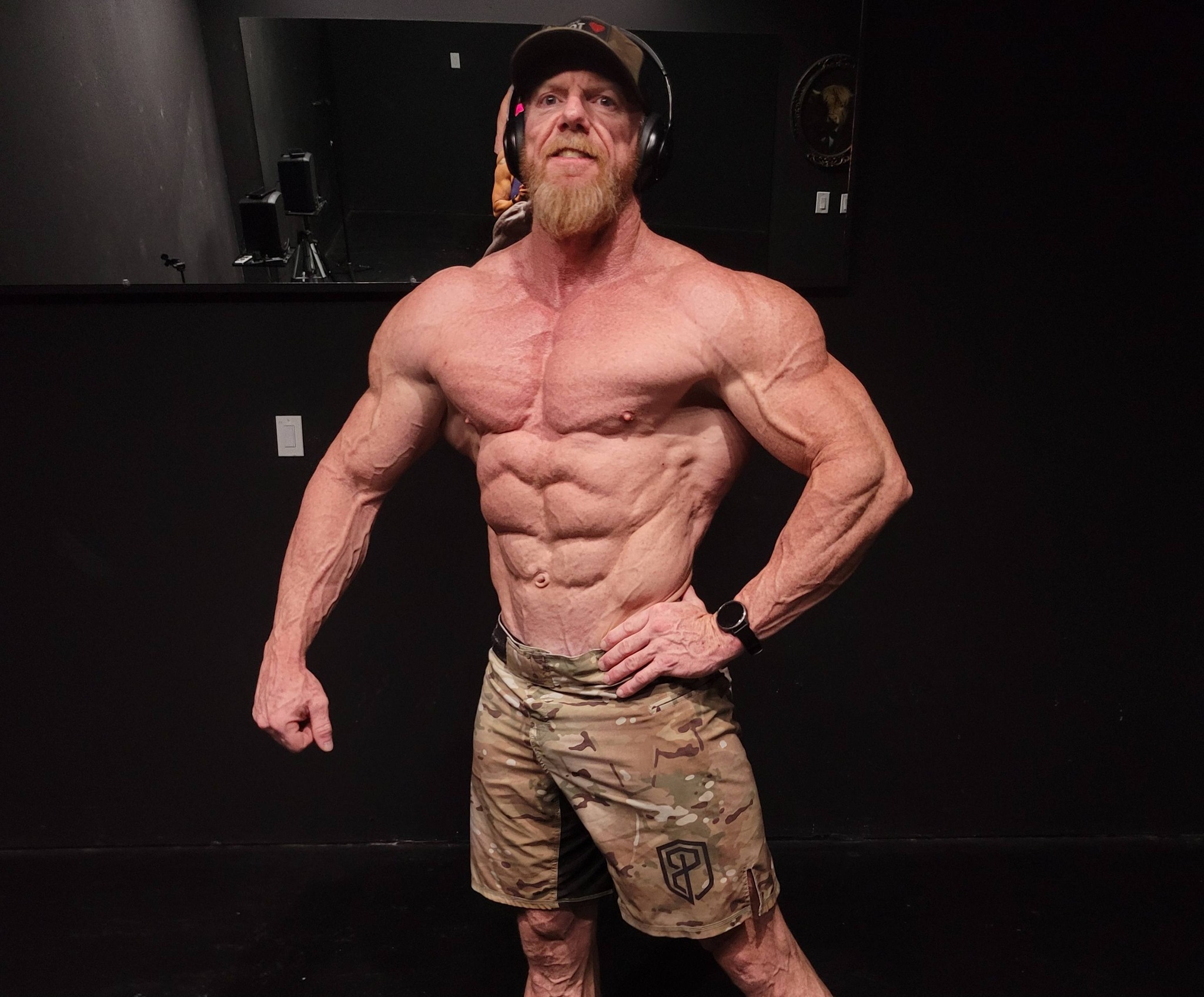 melanotan bodybuilding forum 2 weeks out from Pro Masters World Championships prep update CFILIHTC NAC Gummies 600mg, Flavour:Fruit Punch 🍐 health-and-wellness