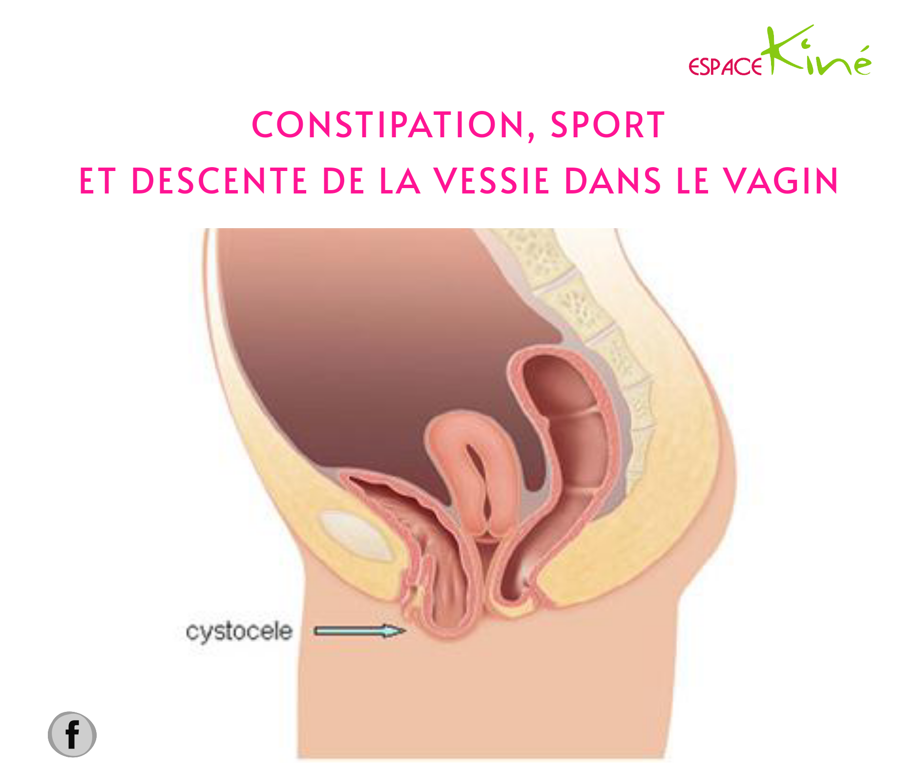 Photo Descente D Organe Chez L Homme