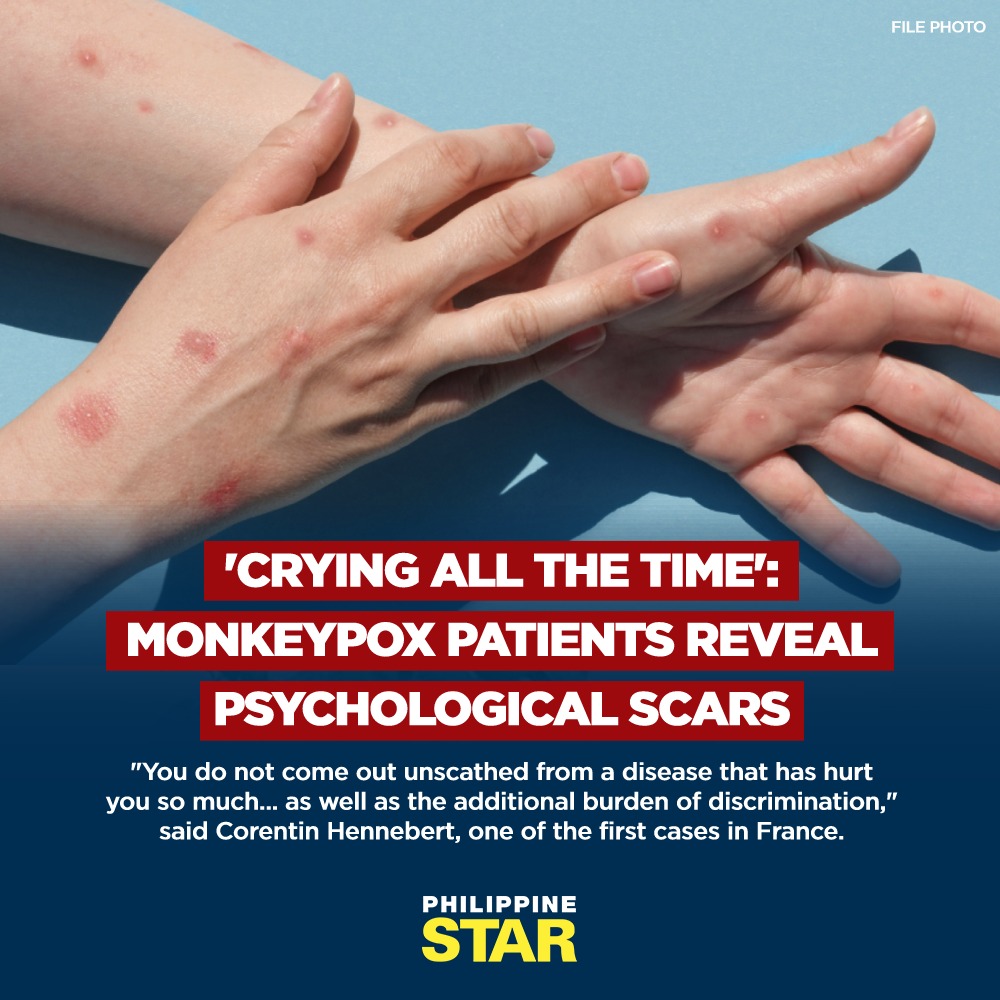Philippine Star - The monkeypox virus may cause intense... | Facebook