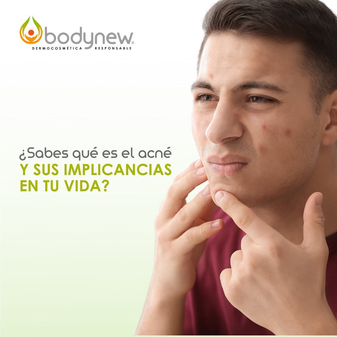 Bodynew - El acné es una enfermedad que afecta la piel,... | Facebook