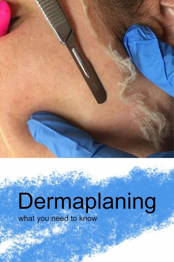 SPMYJwellness&Beauty Academy - Yokohama Japan - WHAT IS DERMAPLANING ...