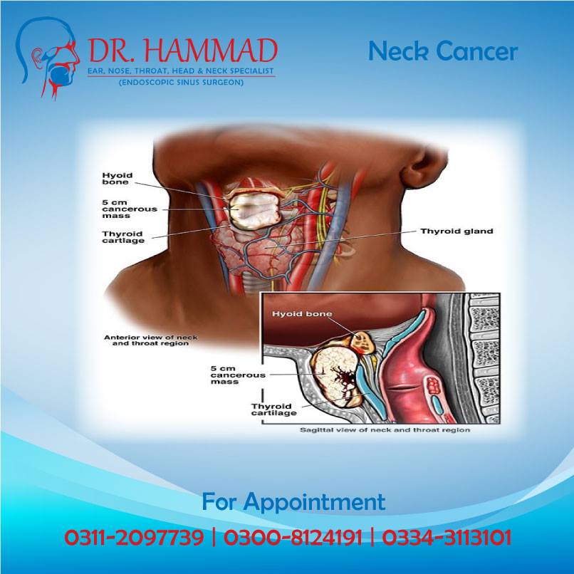 Some common... - Dr. Hammad - ENT, Head & Neck Specialist | Facebook