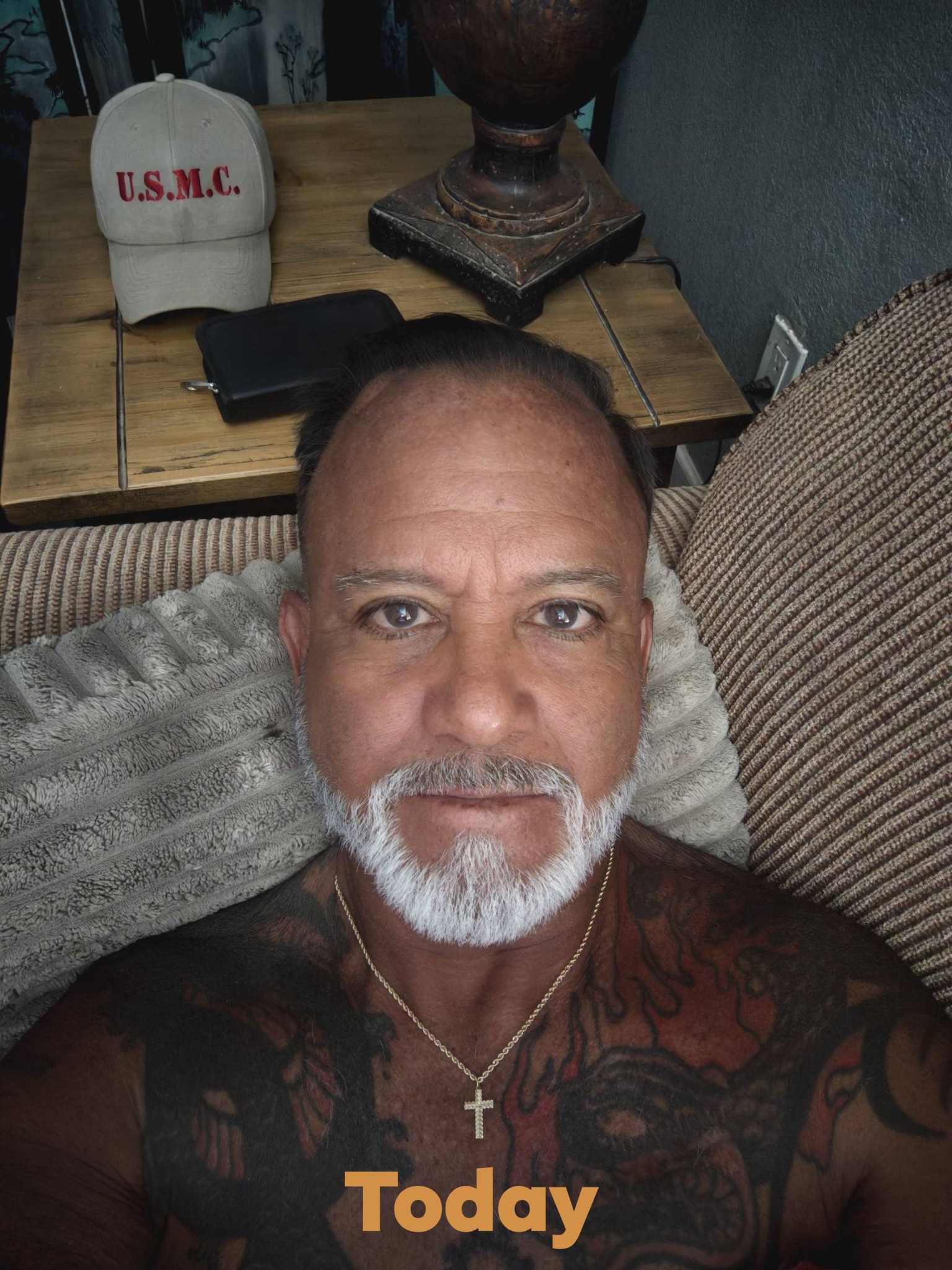 Does ghk-cu stimulate hair regrowth for male pattern baldness?