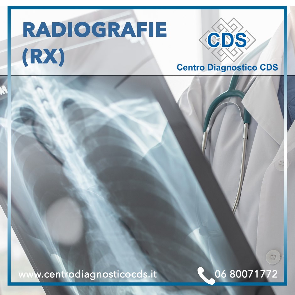 👉 RADIOGRAFIE (RX) Al CDS puoi... - Centro Diagnostico CDS