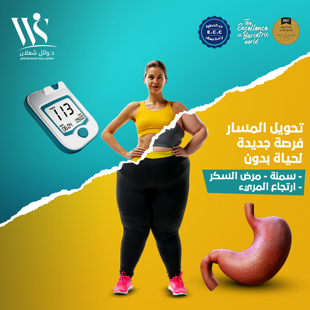 د / وائل شعلان - استشارى جراحات السمنة والمناظير - عملية تحويل المسار ...