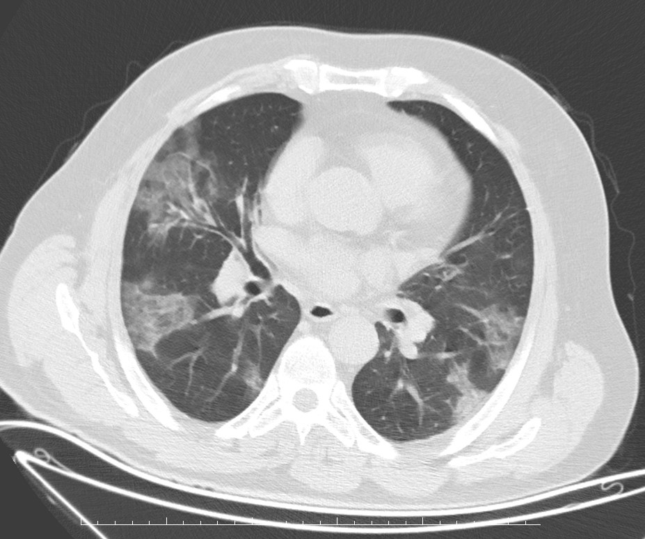 Radiology Case Cafe