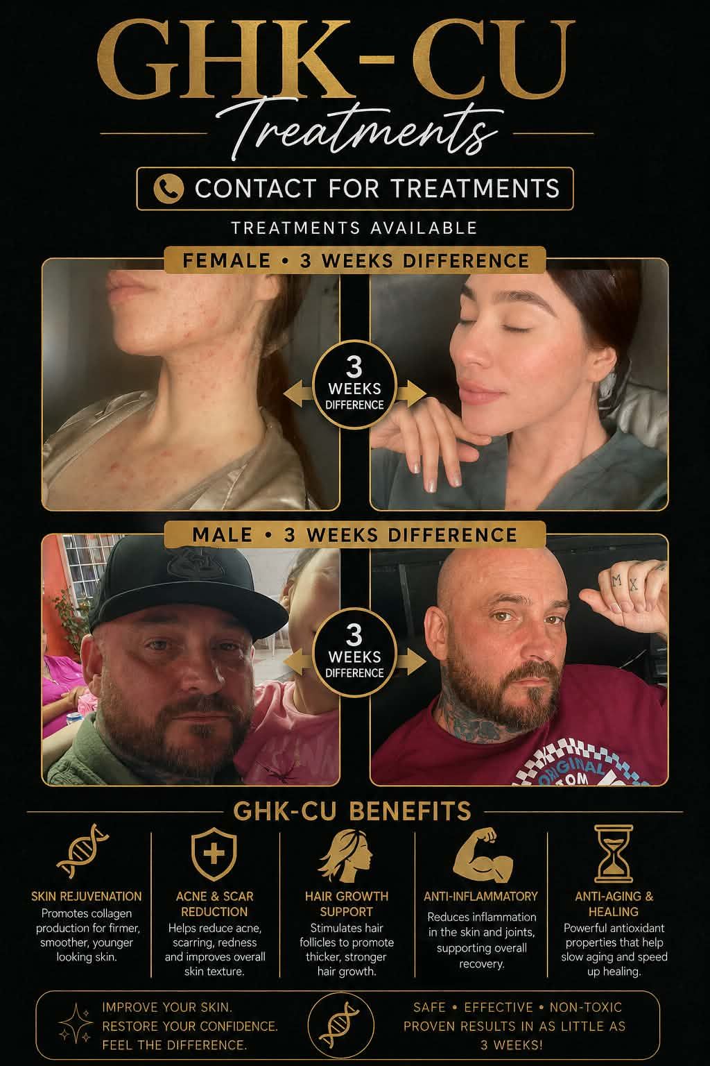 nad+ vs ghk cu Two power players. Very different roles. Let's talk vs. GHK-Cu 🧬✨ NAD+ works behind the scenes—supporting cellular energy, metabolic function, brain clarity, and overall longevity. Think internal optimization, from the inside Buy NAD Injection - Fast
