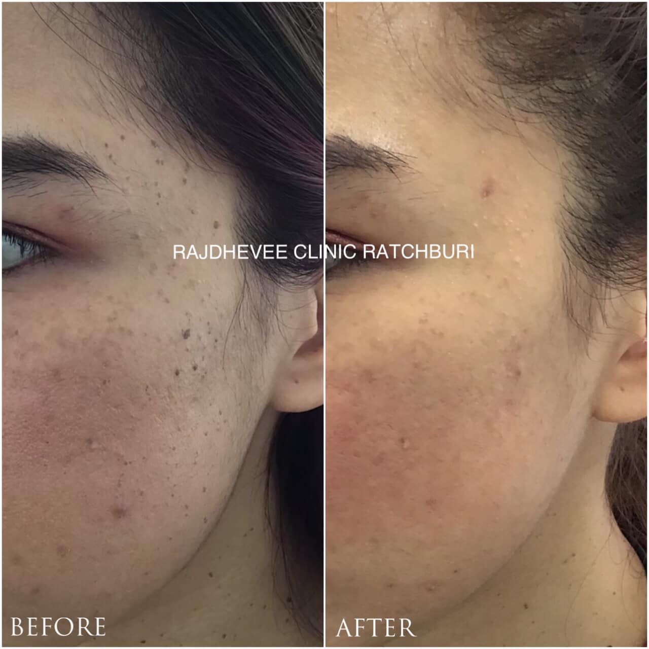 📍... - ราชเทวีคลินิก สาขาราชบุรี - Rajdhevee Clinic Ratchaburi