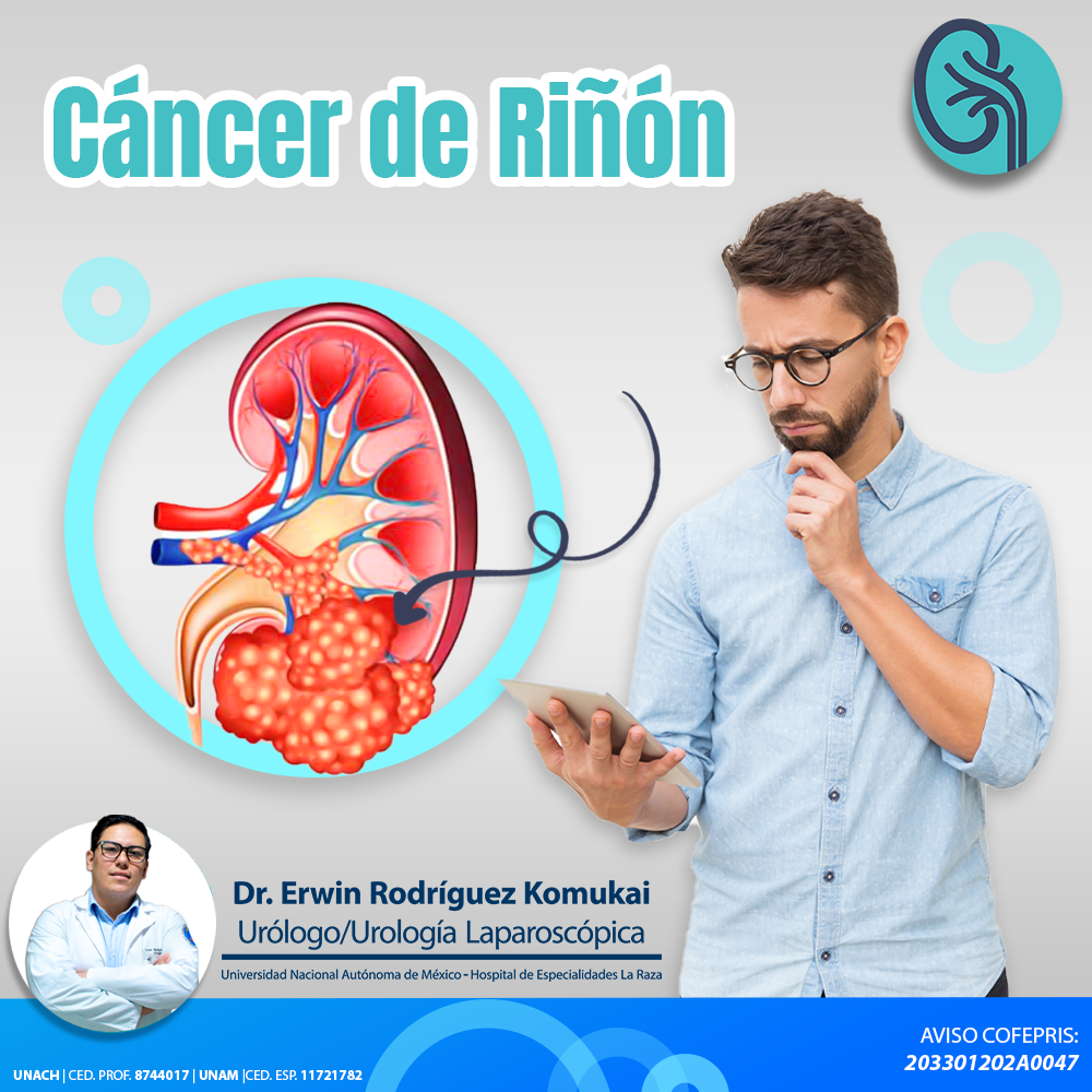 CÁNCER DE RIÑÓN 👨🏻‍⚕️⬇️ Es una enfermedad que se produce cuando las ...