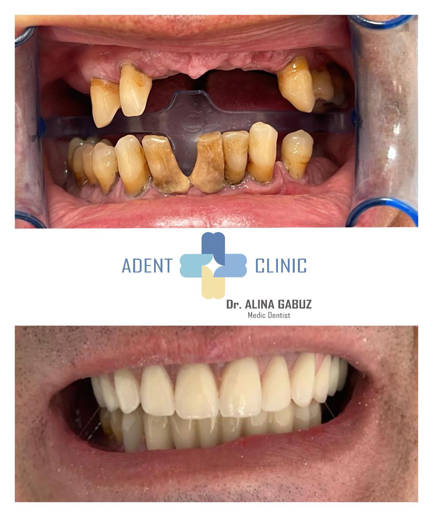 Adent + Clinic | Calarasi