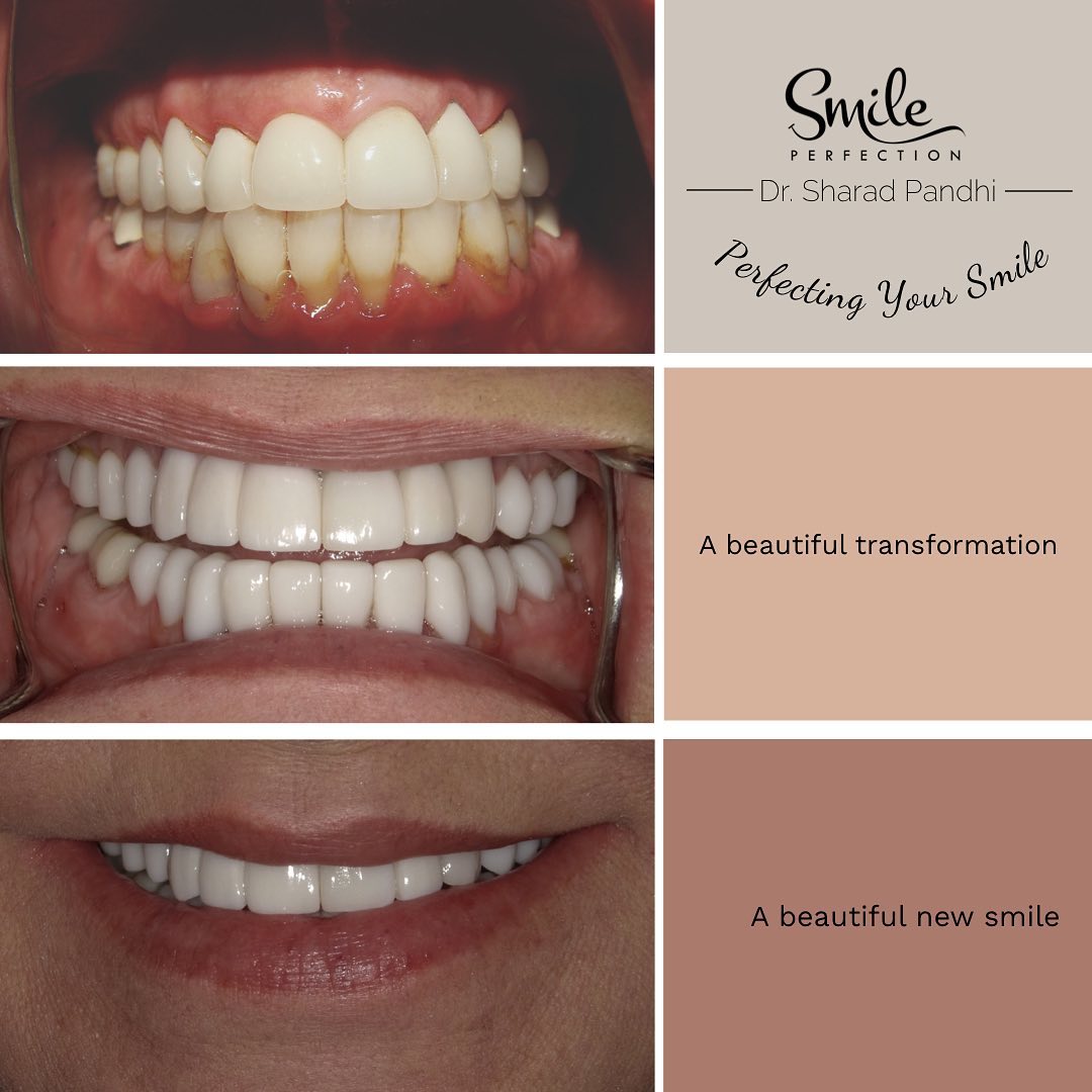 25 Best Cosmetic Dentist Near Tucson, Arizona | Facebook ...