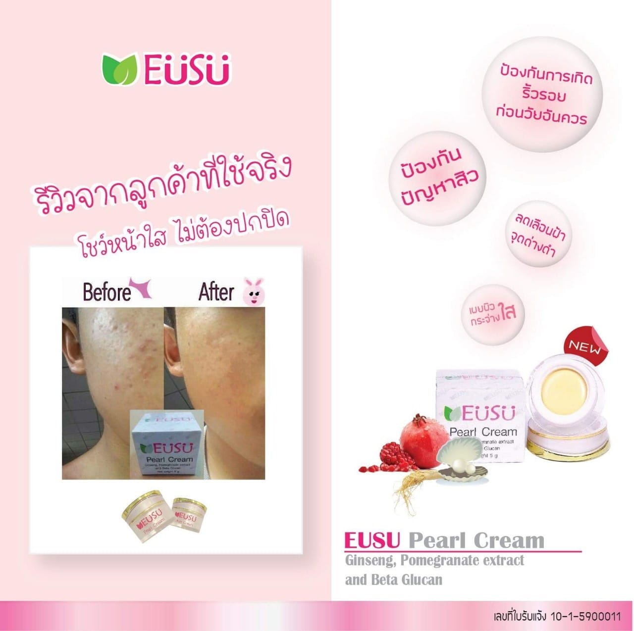 ตามหา คนมี สิว ฝ้า กระ ริ้วรอย... - EUSU ผลิตภัณฑ์ดูแลผิวหน้า | Facebook