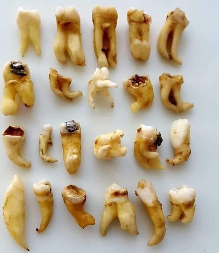 Dental Factory - Different shapes of teeth. Take care of... | Facebook
