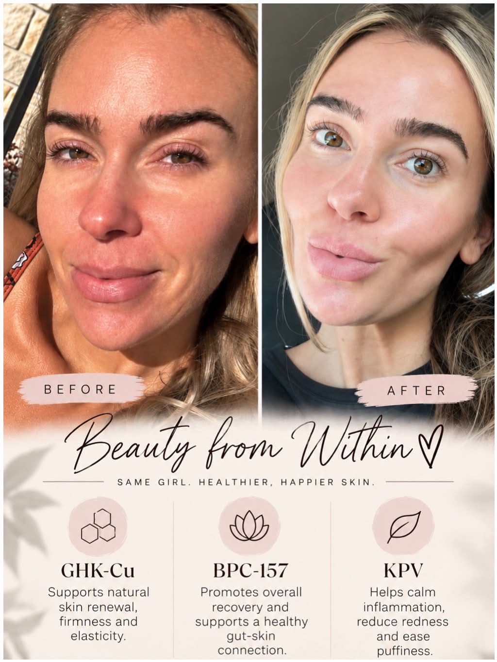 does ghk cu help with redness Jocelyn MB12 - Methylcobalmin