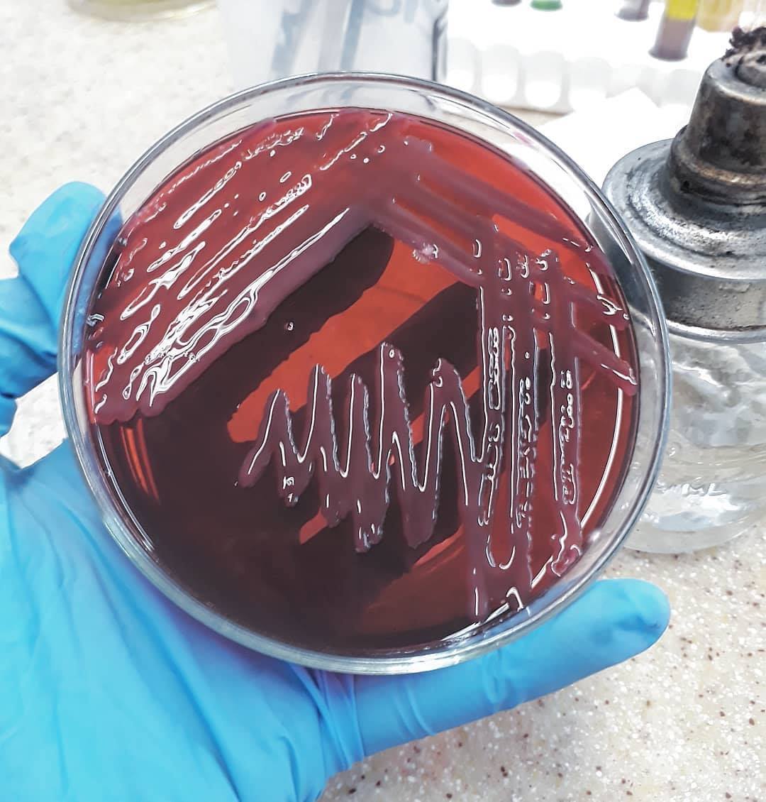 Microbe Notes - Klebsiella oxytoca. It is a Gram-negative,... | Facebook