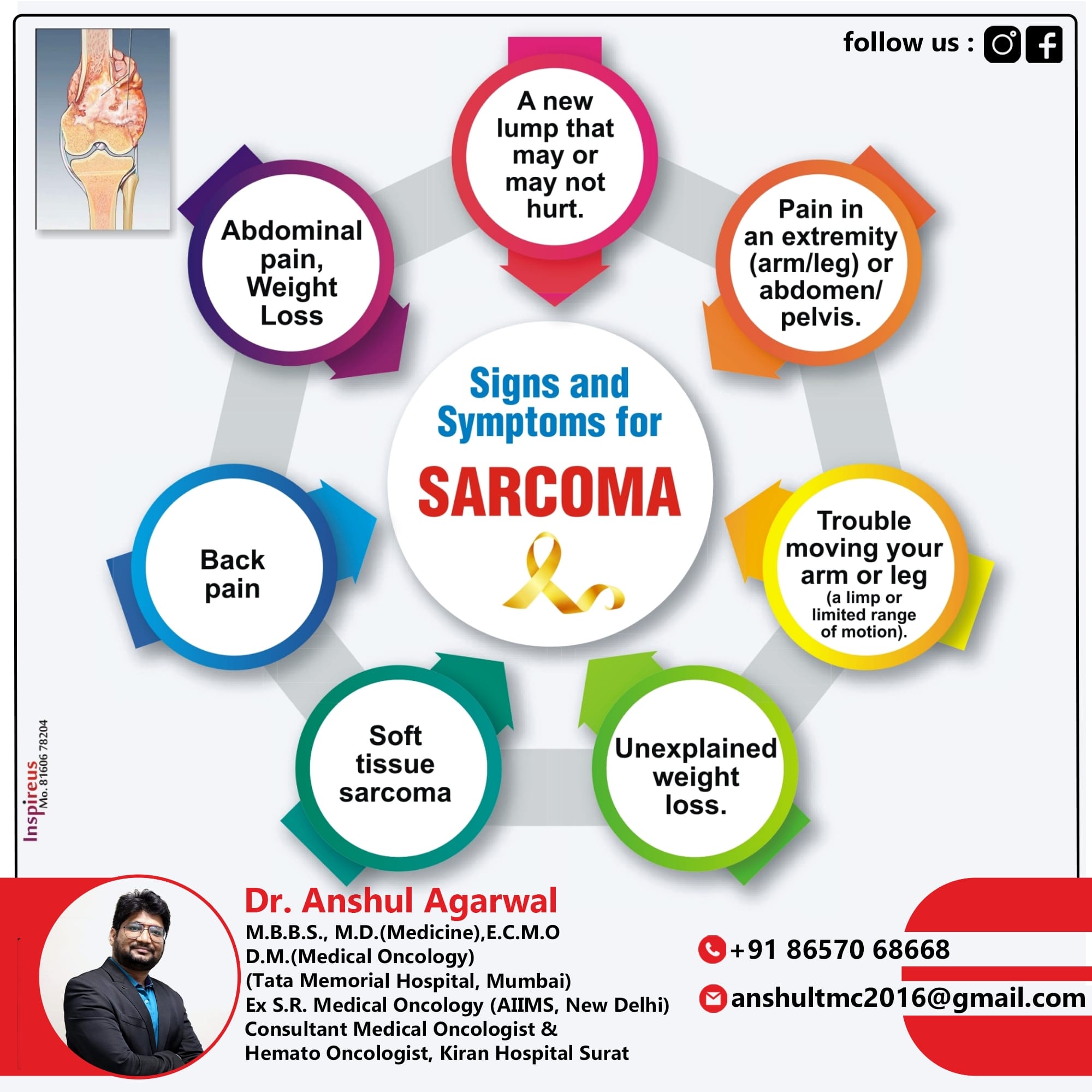 Signs and Symptoms of Sarcoma. . .... - Dr. Anshul Agarwal