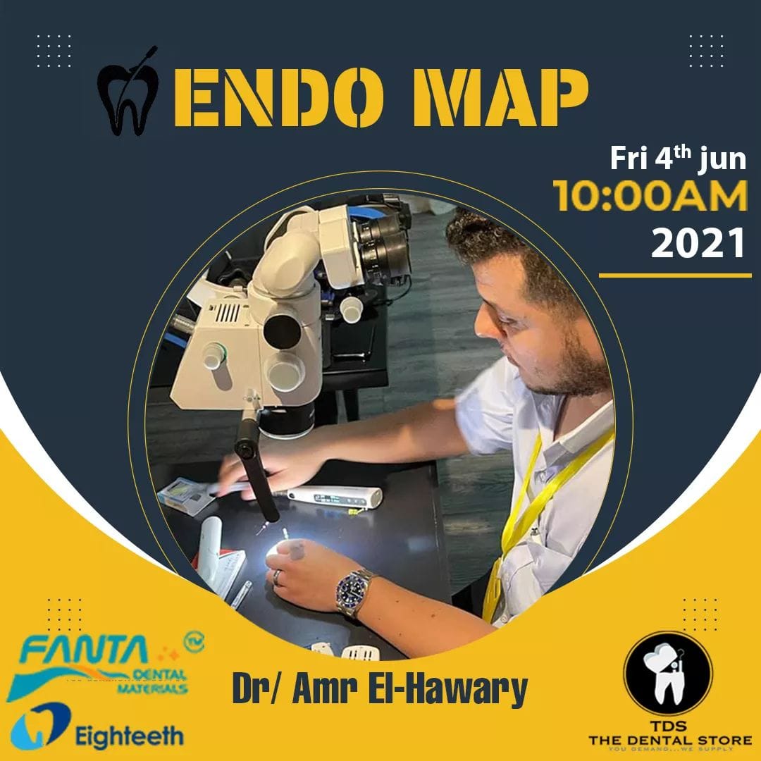 🔴ENDO Map With Dr Haywary 🔝 علشان... - TDS Dental Academy