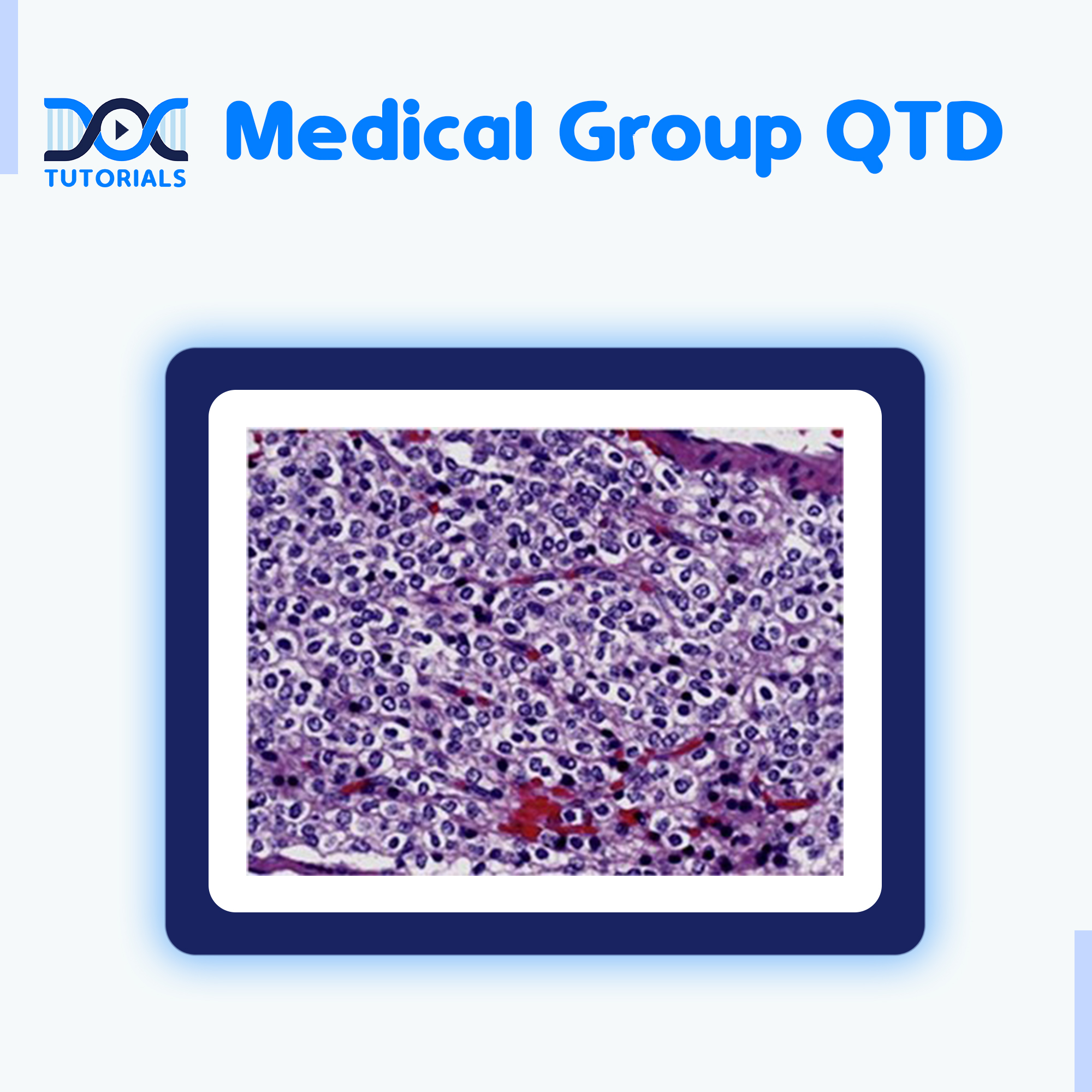 DocTutorials - 💊 Medical Group QTD Question: Identify the disease ...